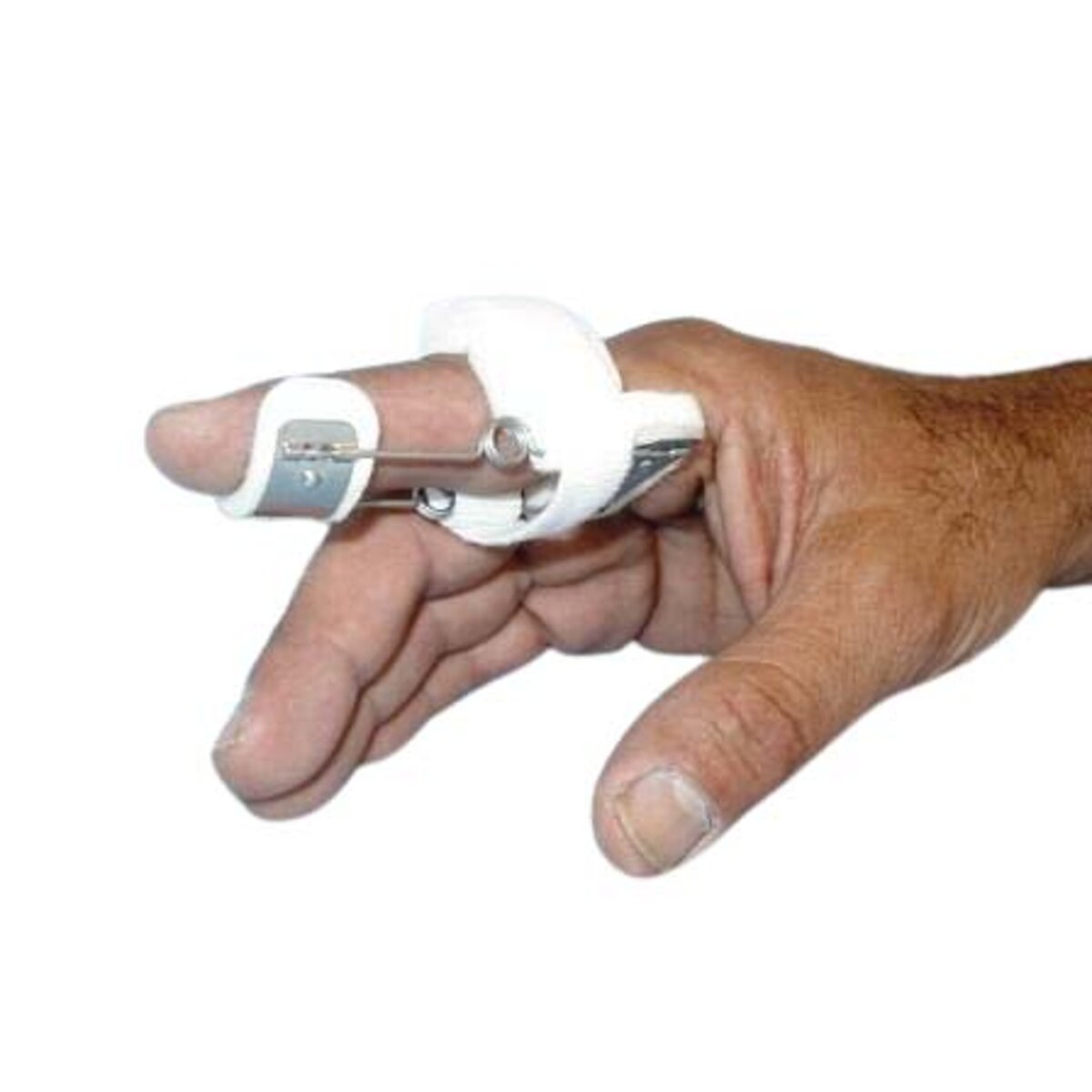 Modified Safety Pin Splint