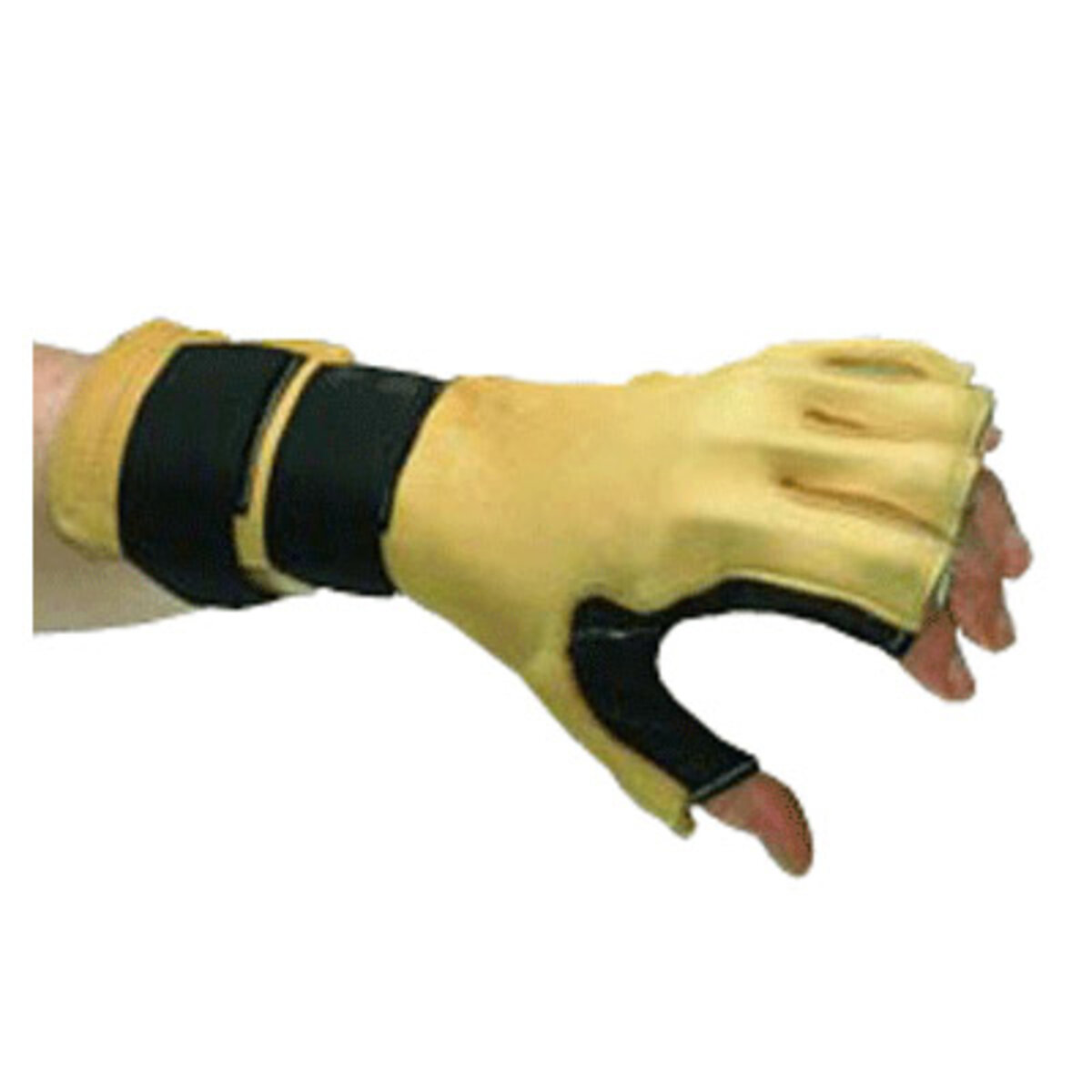 Robinson Forearm-Based Radial Nerve Splint