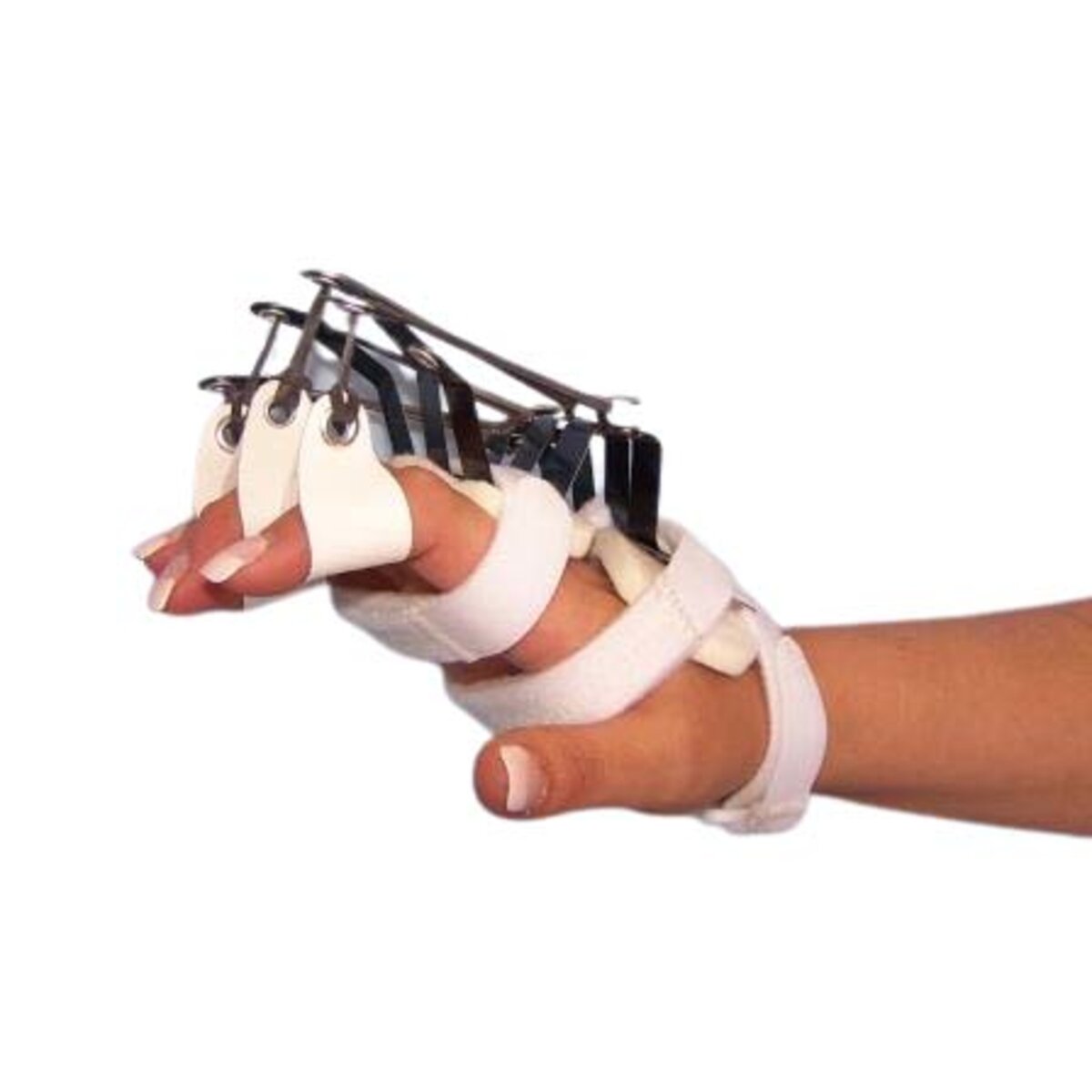 Composite Spring Elastic Splint