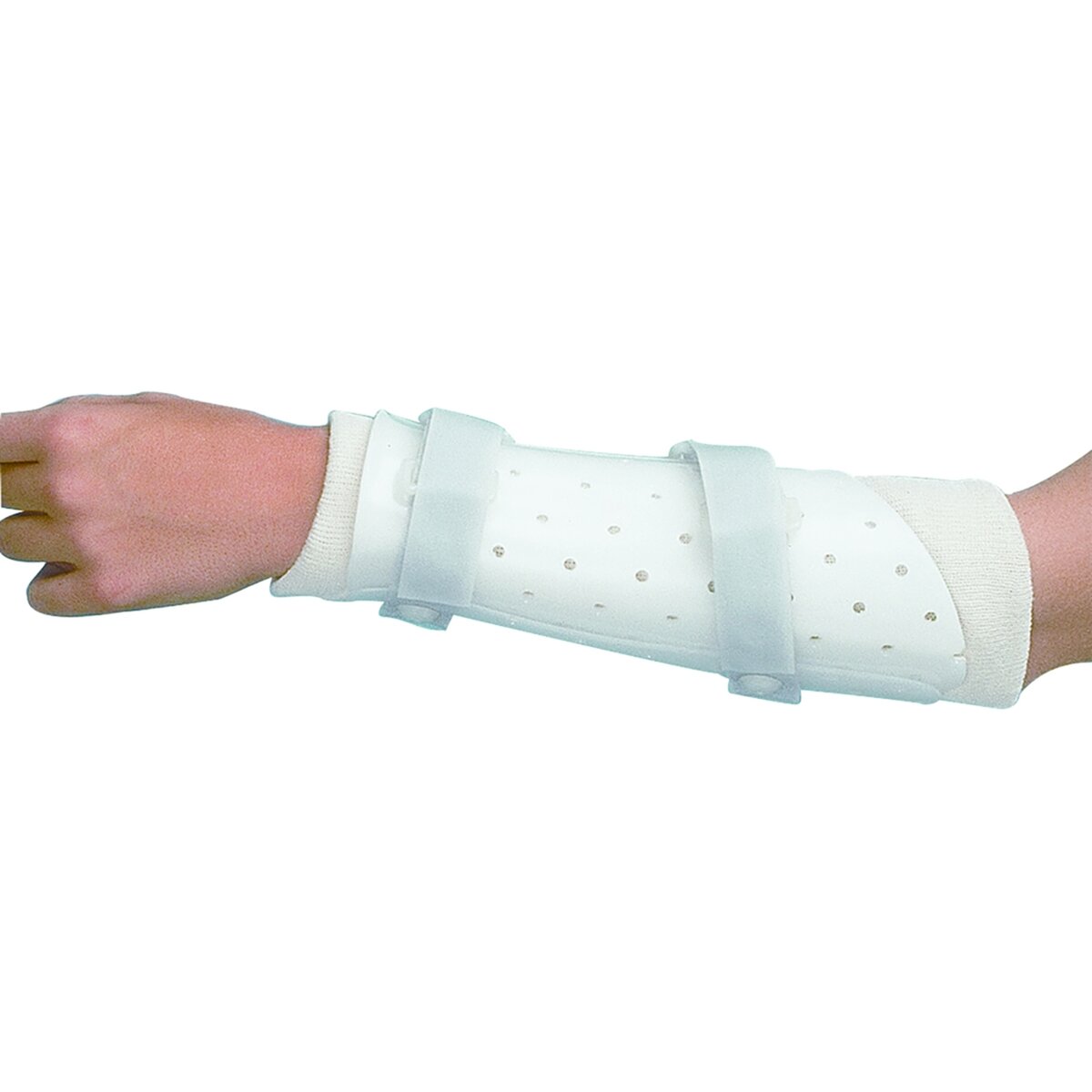 Miami Prefabricated Ulnar Fracture Brace