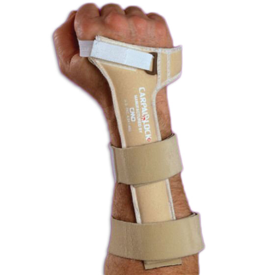 Carpal Lock Wrist Support