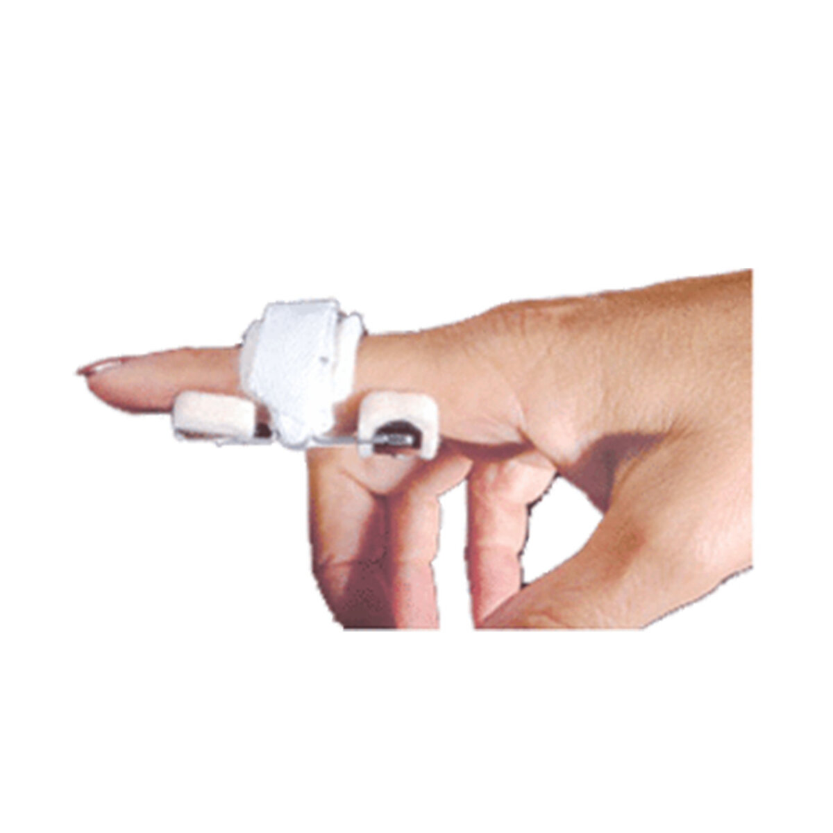 Bunnell Mini-Modified Safety Pin Splint
