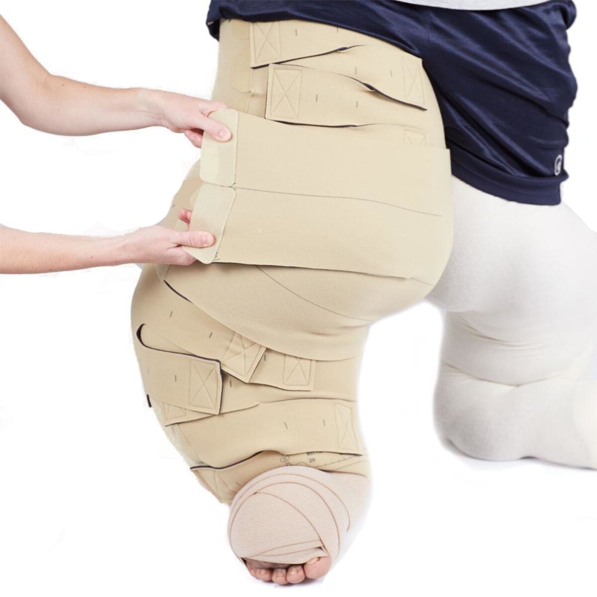 circaid reduction kit full leg