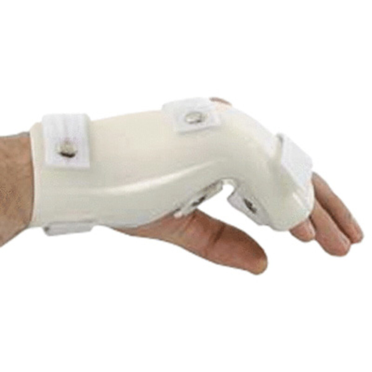 G-Force Boxer's Fracture Orthosis with MP Flexion